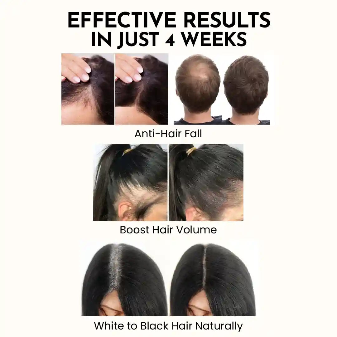 Clinically Proven AMRITKESH Black Root Natural Hair Oil