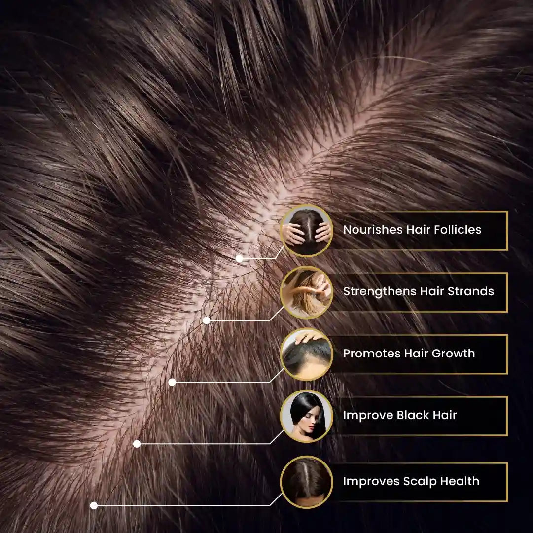 Deeply Conditioning Hair Growth Oil for Hair Fall, Alopecia, Balding and Dandruff