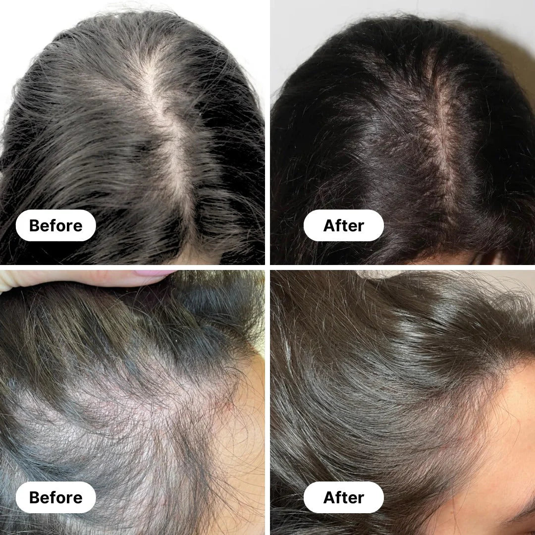 Clinically Proven AMRITKESH Black Root Natural Hair Oil