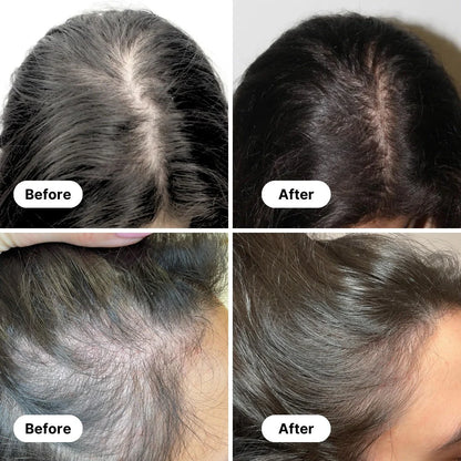 Amritkesh™ BlackRoot Revival Elixir