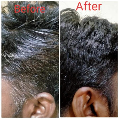 Amritkesh™ BlackRoot Revival Elixir